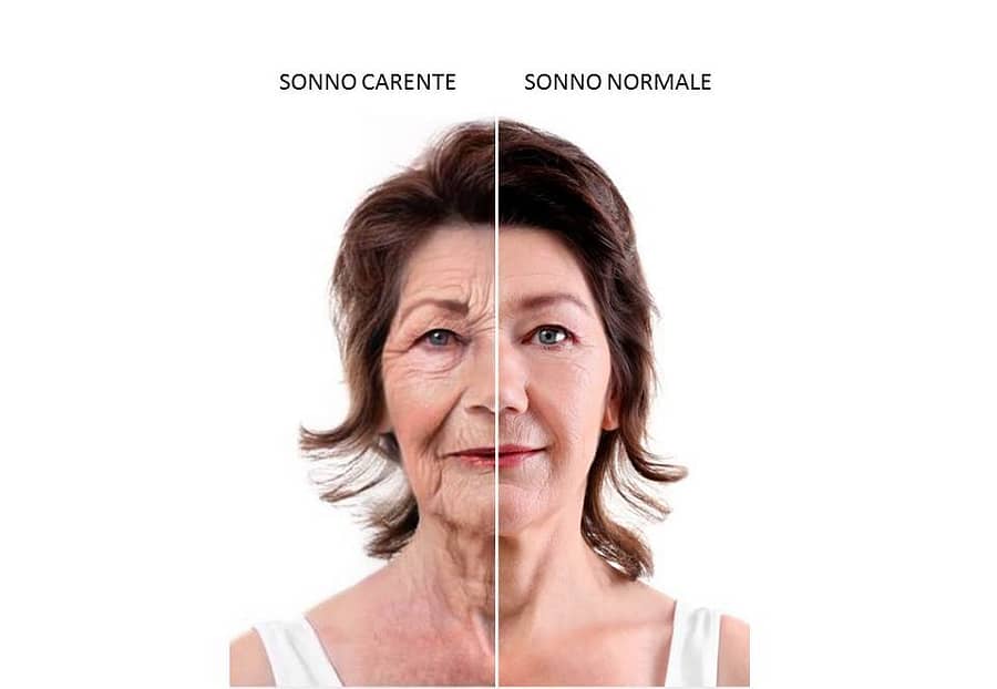mancanza del sonno - disturbi del sonno